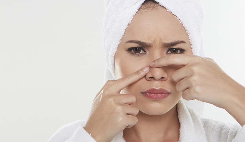 Face Mapping: What Your Pimples Are Trying To Tell You